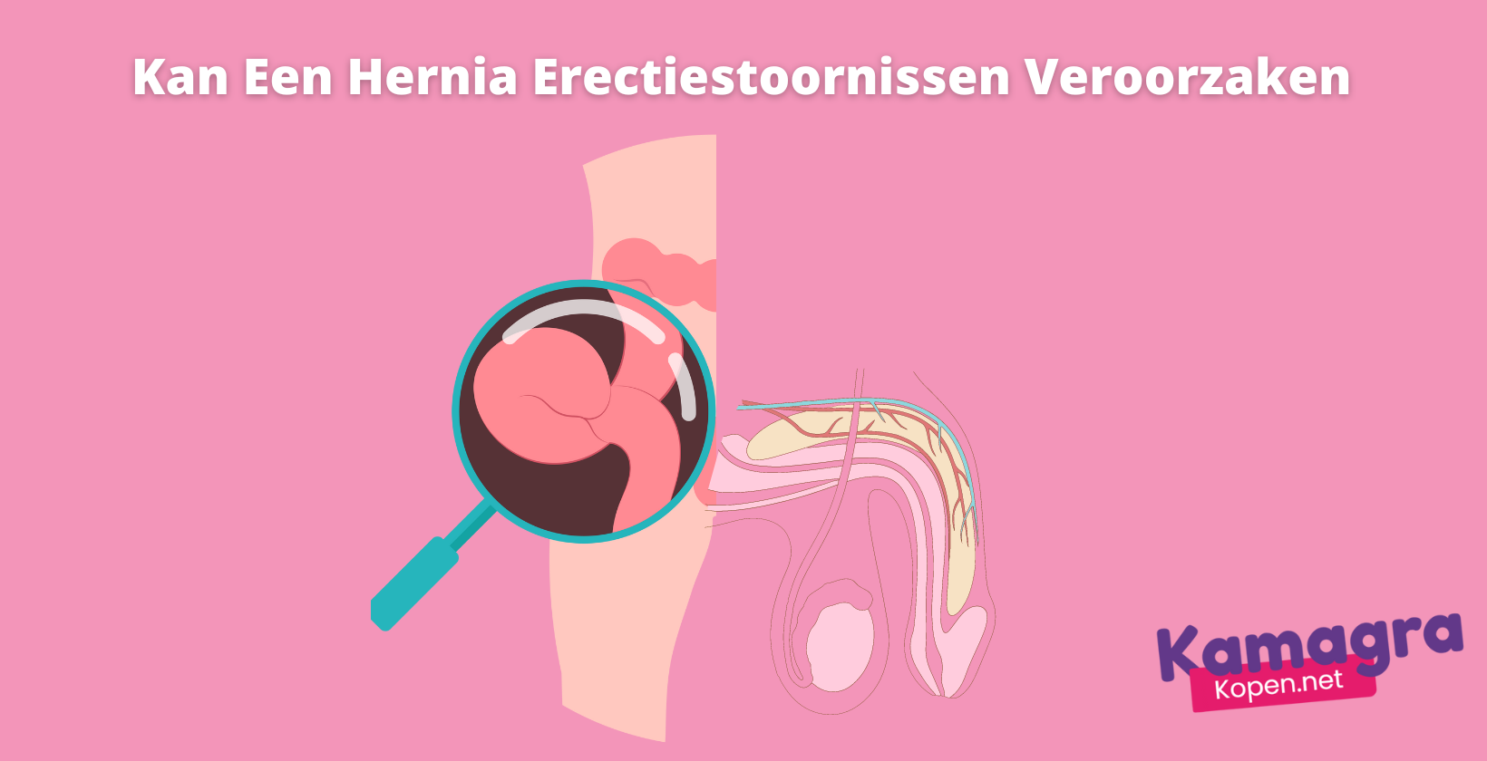 Kan een hernia erectiestoornissen veroorzaken