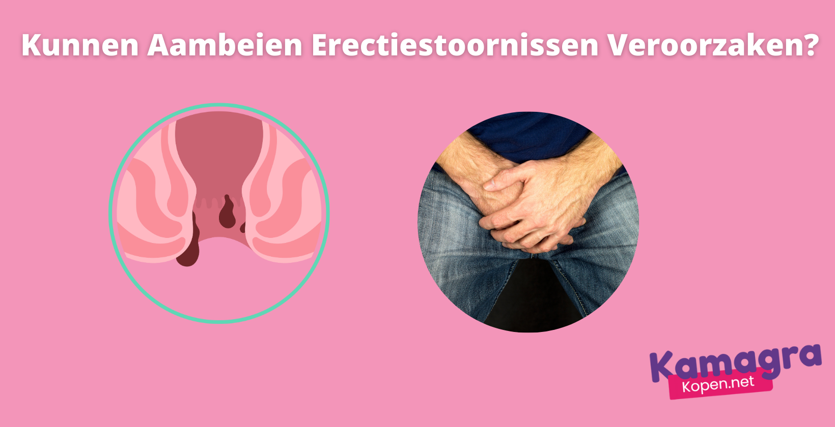 Kunnen aambeien erectiestoornissen veroorzaken