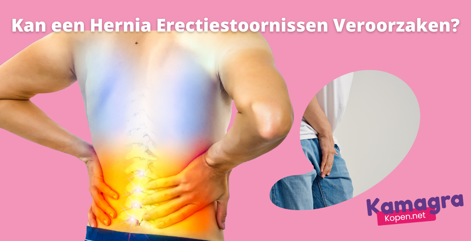 Hernia en erectiestoornissen