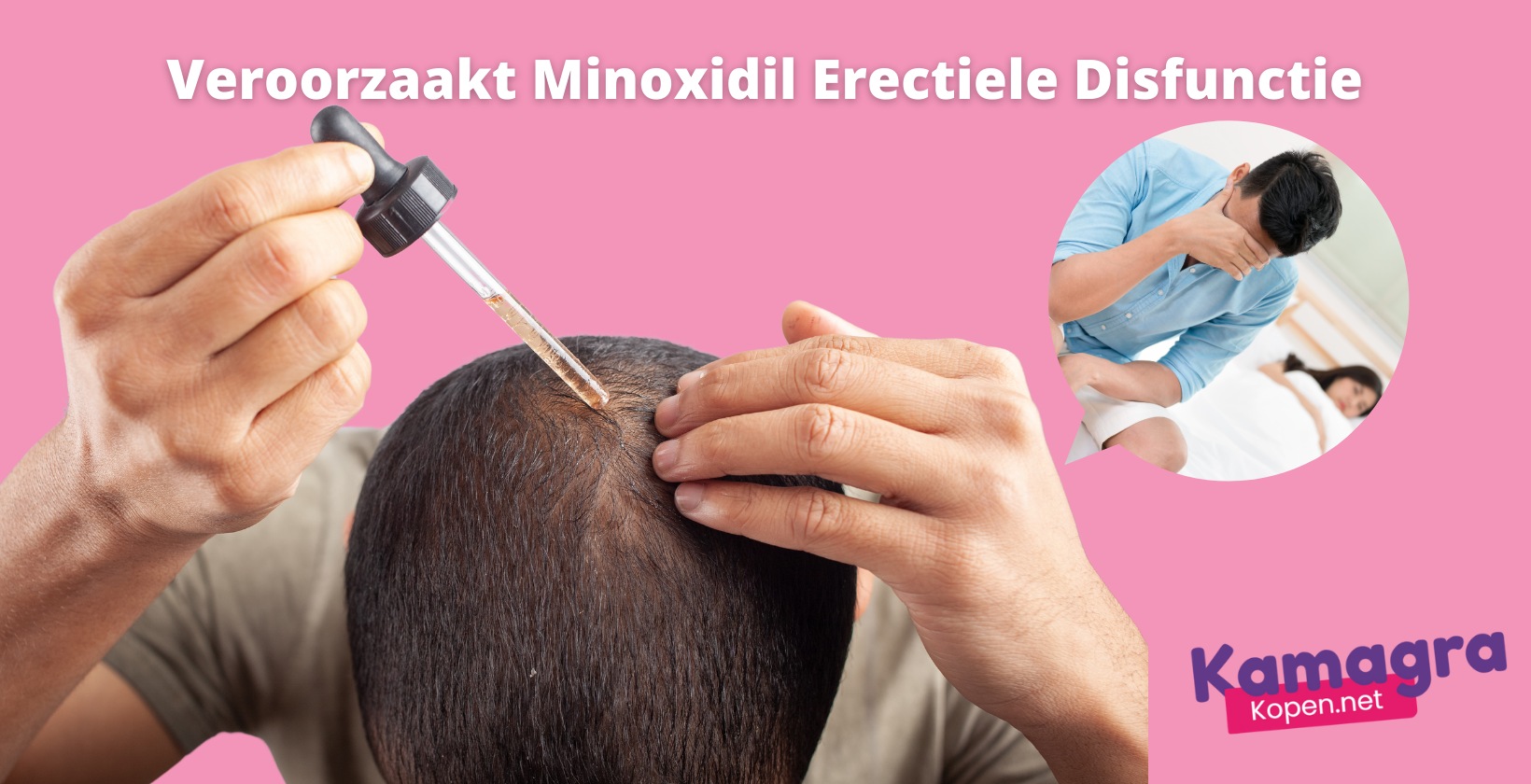 Minoxidil veroorzaakt erectiestoornissen