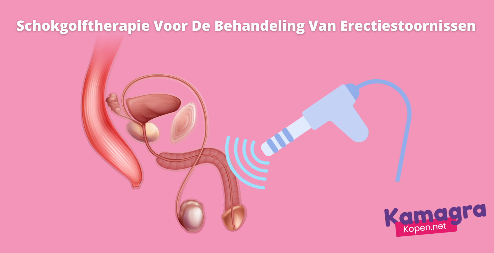 Shockwave-therapie voor erectiestoornissen